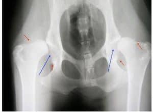 Hip dysplasia