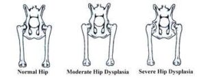normal vs dysplastic hip bone structure