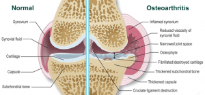 Arthritis in dogs